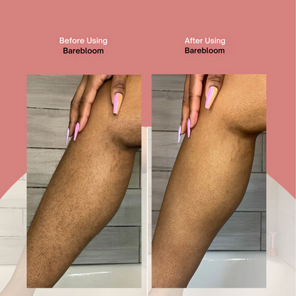 My SmoothShave Pro | All-in-One Electric Shaver for Women