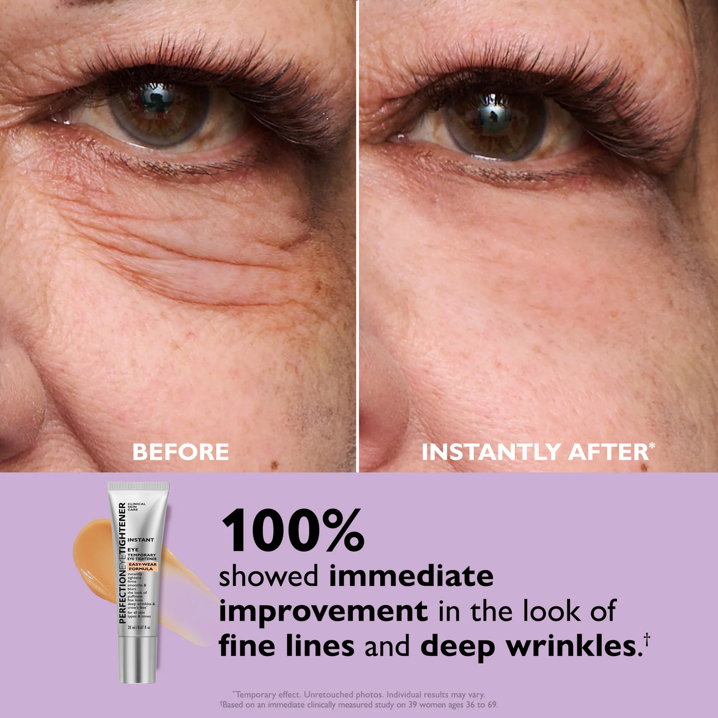 Peter Thomas Roth | Instant FIRMx® Eye Temporary Eye Tightener Easy-Wear Formula